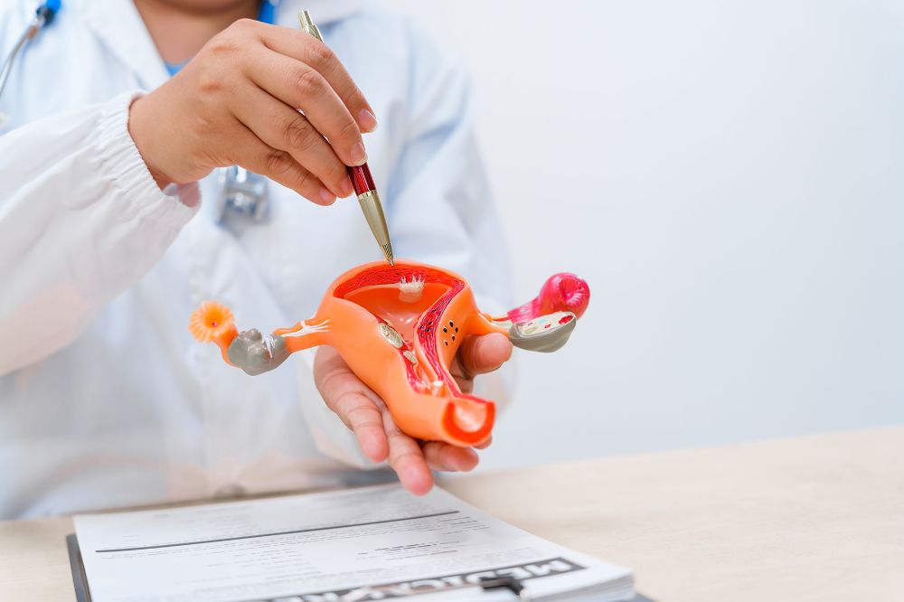 Síndrome de ovario poliquístico es una enfermedad endocrinológica, metabólica y reproductiva, de carácter crónico, que se caracteriza principalmente porque los ovarios en ciertas mujeres producen una mayor cantidad de hormonas masculinas de lo habitual.